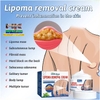 HŨ KEM THẢO MỘC LOẠI BỎ ĐÁNH TAN U MỠ BƯỚU CỔ SHOOTMOON LIPOMA 50GR