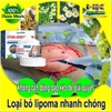 HŨ KEM THẢO MỘC LOẠI BỎ ĐÁNH TAN U MỠ BƯỚU CỔ SHOOTMOON LIPOMA 50GR