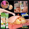 KEM LOẠI BỎ ĐÁNH TAN U MỠ BƯỚU CỔ TUYẾN GIÁP DƯỚI DA SUMIFUN LIPOMA LIPOLYSIS 20GR- THẢO DƯỢC THIÊN NHIÊN