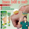 KEM LOẠI BỎ ĐÁNH TAN U MỠ BƯỚU CỔ TUYẾN GIÁP DƯỚI DA SUMIFUN LIPOMA LIPOLYSIS 20GR- THẢO DƯỢC THIÊN NHIÊN