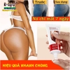 KEM NÂNG MÔNG NỞ MÔNG LÀM TRẮNG NGỪA THÂM GONGPEI 60G THƯƠNG HIỆU HÀNG ĐẦU HÀN QUỐC