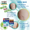 KEM TAN TUYẾN GIÁP, CƯỜNG GIÁP SENJOKO NHẬT BẢN 50GR- HỖ TRỢ HIỆU QUẢ U MỠ, BƯỚU CỔ, U XƠ TUYẾN VÚ
