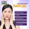 KEM TRỊ GIẢM NÁM TÀN NHANG CLOBETAMIL G NHẬP KHẨU THÁI LAN