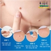 [CHUẨN 100% HÀNG CTY] KEM BÔI LOẠI BỎ MỤN, NÁM, TÀN NHANG, TẨY NỐT RUỒI, LÀM MỜ THÂM SẸO