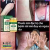 NẤM VƯƠNG HỒNG KÔNG HŨ VÀNG 50GR- CHUYÊN TRỊ NẤM NGỨA, HẮC LÀO TỔ ĐỈA, GHẺ, Á SỪNG, DỊ ỨNG, MỀ ĐAY, VIÊM DA CƠ ĐỊA 