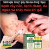NẤM VƯƠNG HỒNG KÔNG HŨ VÀNG 50GR- CHUYÊN TRỊ NẤM NGỨA, HẮC LÀO TỔ ĐỈA, GHẺ, Á SỪNG, DỊ ỨNG, MỀ ĐAY, VIÊM DA CƠ ĐỊA 