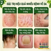 NẤM VƯƠNG HỒNG KÔNG HŨ VÀNG 50GR- CHUYÊN TRỊ NẤM NGỨA, HẮC LÀO TỔ ĐỈA, GHẺ, Á SỪNG, DỊ ỨNG, MỀ ĐAY, VIÊM DA CƠ ĐỊA 