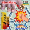 KEM BÔI KHÁNG KHUẨN ĐẶC TRỊ NẤM NGỨA, NẤM MÓNG TAY CHÂN BỌ CẠP ĐEN 15GR- NỘI ĐỊA TRUNG [CHUẨN 100% HÀNG CTY]