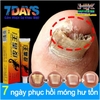 KEM BÔI KHÁNG KHUẨN ĐẶC TRỊ NẤM NGỨA, NẤM MÓNG TAY CHÂN BỌ CẠP ĐEN 15GR- NỘI ĐỊA TRUNG [CHUẨN 100% HÀNG CTY]