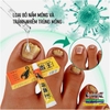 KEM BÔI KHÁNG KHUẨN ĐẶC TRỊ NẤM NGỨA, NẤM MÓNG TAY CHÂN BỌ CẠP ĐEN 15GR- NỘI ĐỊA TRUNG [CHUẨN 100% HÀNG CTY]