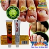 KEM BÔI KHÁNG KHUẨN ĐẶC TRỊ NẤM NGỨA, NẤM MÓNG TAY CHÂN BỌ CẠP ĐEN 15GR- NỘI ĐỊA TRUNG [CHUẨN 100% HÀNG CTY]