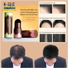 PHẤN PHỦ CHÂN TÓC SUAKE GIÚP CHE KHUYẾT ĐIỂM LỘ CHÂN TÓC TÓC THƯA