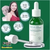 SERUM AXIT SALICYLIC 30ML/ 60GR- TINH CHẤT SE KHÍT, THU NHỎ LỖ CHÂN LÔNG, LỘT MỤN ĐẦU ĐEN, DƯỠNG TRẮNG CHỐNG LÃO HÓA, TRẺ HÓA LÀN DA