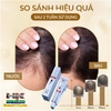 SERUM TINH CHẤT NGĂN RỤNG TÓC, KÍCH THÍCH MỌC TÓC SEEFAIR DẠNG LĂN DỄ SỬ DỤNG