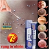 SOUTH MOON 20GR- KEM XOÁ MỤN CÓC, MỤN THỊT, LOẠI BỎ MỤN CÓC THÔNG THƯỜNG, MỤN ĐÁ, MỤN CƠM, MỤN CÓC DẠNG SỢI