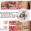 SUMIFUN 20GR- KEM BÔI DA LIỄU NAM NỮ BÔI NẪM NGỨA VÙNG SINH DỤC DO MỤN, SÙI MÀO GÀ, NHIỄM HPV...THẢO MỘC 100%