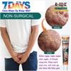 SUMIFUN 20GR- KEM BÔI DA LIỄU NAM NỮ BÔI NẪM NGỨA VÙNG SINH DỤC DO MỤN, SÙI MÀO GÀ, NHIỄM HPV...THẢO MỘC 100%