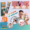 SUMIFUN 20GR- KEM BÔI DA LIỄU NAM NỮ BÔI NẪM NGỨA VÙNG SINH DỤC DO MỤN, SÙI MÀO GÀ, NHIỄM HPV...THẢO MỘC 100%