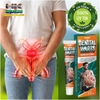 SUMIFUN 20GR- KEM BÔI DA LIỄU NAM NỮ BÔI NẪM NGỨA VÙNG SINH DỤC DO MỤN, SÙI MÀO GÀ, NHIỄM HPV...THẢO MỘC 100%