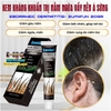 KEM KHÁNG KHUẨN TRỊ NẤM NGỨA VẨY NẾN Á SỪNG EBORRHEIC DERMATITIS- SUMIFUN 20GR- ĐẶC TRỊ NẤM ĐẦU GÀU NGỨA, VIÊM DA TIẾT BÃ CHĂM SÓC DA TOÀN THÂN