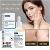 TINH CHẤT SỬA CHỮA THU NHỎ LỖ CHÂN LÔNG, DƯỠNG ẨM NUÔI DƯỠNG DA MẶT MỀM MỊN- LACTOBIONIC HYALURONIC ACID 30ML