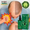 XỊT DƯỠNG KÍCH THÍCH MỌC TÓC HAIR NUTRIENT SOLUTION 120ML XUẤT XỨ THÁI LAN