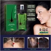 XỊT DƯỠNG KÍCH THÍCH MỌC TÓC OUHOE LOTION 120ML THƯƠNG HIỆU THÁI LAN