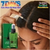 XỊT DƯỠNG KÍCH THÍCH MỌC TÓC OUHOE LOTION 120ML THƯƠNG HIỆU THÁI LAN