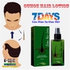 XỊT DƯỠNG KÍCH THÍCH MỌC TÓC OUHOE LOTION 120ML THƯƠNG HIỆU THÁI LAN