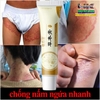 [CHUẨN 100% HÀNG CTY] ZHIBAIDO CÔNG THỨC BÍ TRUYỀN- KEM THẢO MỘC BÔI GIẢM NGAY NẤM NGỨA, VẢY NẾN, Á SỪNG, MỀ ĐAY, TỔ ĐỈA...