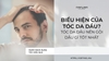 Biểu hiện của tóc da dầu? Tóc da dầu nên gội dầu gì tốt nhất