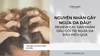Nguyên nhân gây ngứa da đầu? Review các sản phẩm dầu gội trị ngứa da đầu hiệu quả