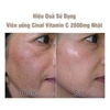 VIÊN UỐNG TRẮNG DA TRỊ NÁM CINALC NHẬT BẢN
