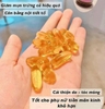Tinh dầu hoa anh thảo Úc 190 viên
