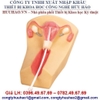 MÔ HÌNH THỰC HÀNH ĐẶT VÒNG TRÁNH THAI GD/F5N