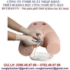 MÔ HÌNH ĐẶT ỐNG THÔNG TIỂU NAM GD/H17E