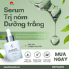 Bộ Đôi Trị Nám Dưỡng Trắng Kem + Serum KN Beauty kèm quà tặng