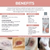 VETERINARY Hot Spot & Itch Relief Shampoo - Sữa Tắm Trị Ngứa & Mụn Nhọt Cho Chó & Mèo 473ml