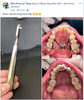 Cây ấn band SA Medical