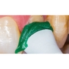 Sò Đánh Bóng Răng DMG Flairesse Prophy Paste (Bạc Hà - Thô - 200 Tép)