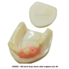 Mô hình thực hành cắm ghép implant, nâng xoang trong Nha khoa