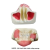 Mô hình thực hành cắm ghép implant, nâng xoang trong Nha khoa