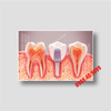 Tranh Implant nha khoa- MS27