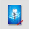 Tranh Implant nha khoa- MS28
