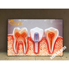 Tranh Implant nha khoa- MS27