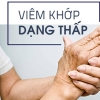 5 lời khuyên về vận động cho người viêm khớp dạng thấp
