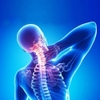 Dấu Hiệu Thoái Hóa Đốt Sống Cổ Và Cách Điều Trị