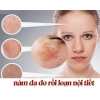 Hiểu đúng nguyên nhân để điều trị nám da hiệu quả