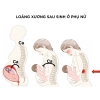 Lý do dẫn đến loãng xương sau sinh và cách phòng ngừa