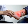 Người trẻ nên làm gì khi mắc bệnh gout?